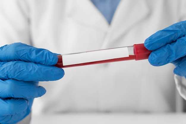 Этапы процесса анализа крови в лаборатории