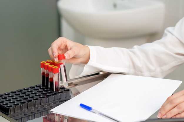 Как приблизить время получения результатов анализа крови