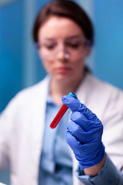 Подготовка крови перед анализом: соблюдение правил и рекомендаций