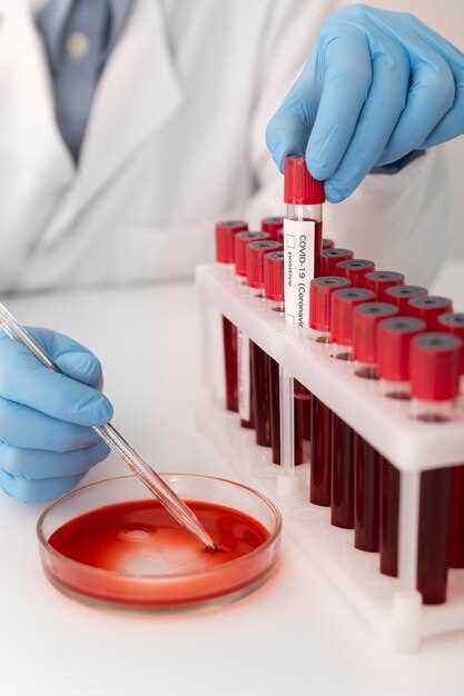 Высокий риск кровотечений: как повысить тромбоциты в крови?