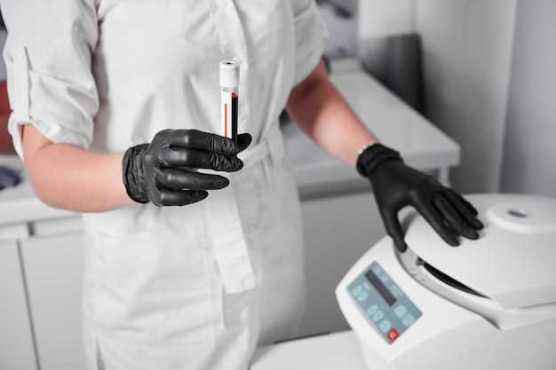 Какие изменения в анализе крови могут свидетельствовать о туберкулезе